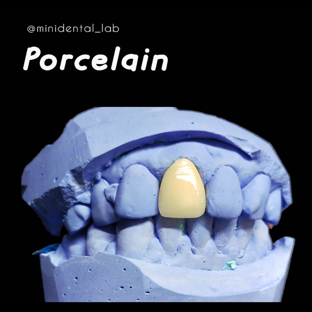 Porcelin