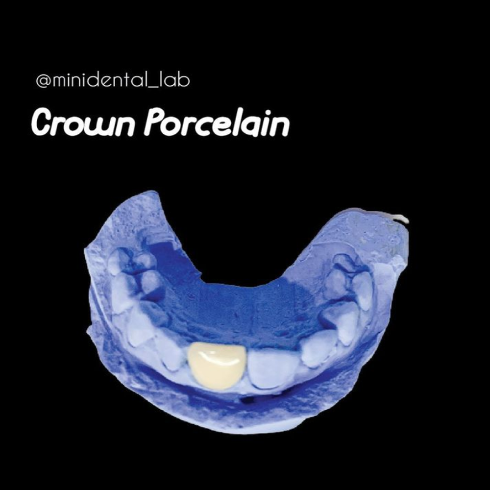 crownporcelain